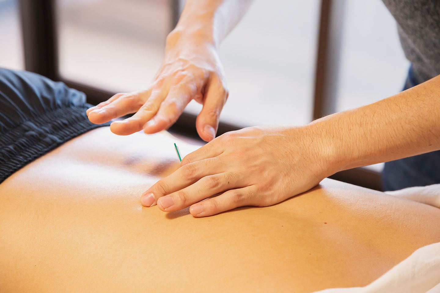 Akupunktur fysioterapi behandling