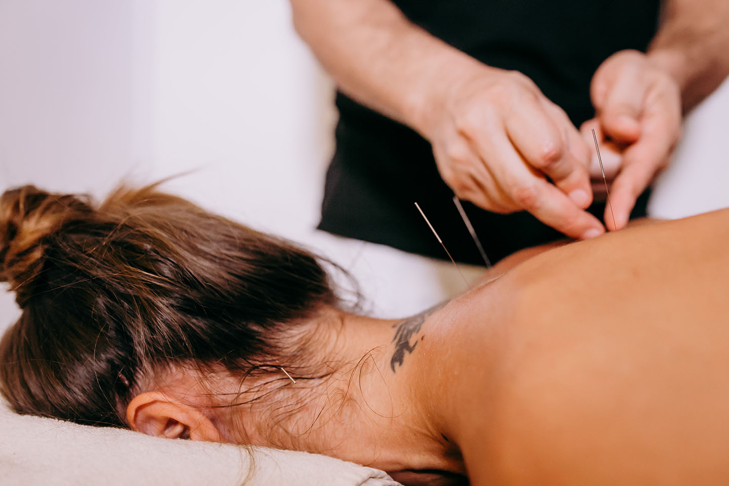 Akupunktur fysioterapi behandling, RAB godkendt akupunktur.